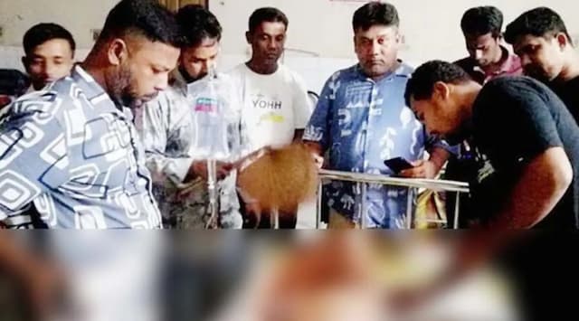ছাত্রদল নেতার গায়ে ফুটন্ত পানি ঢেলে দিলেন কার্যক্রম নিষিদ্ধ আওয়ামী লীগের কর্মী