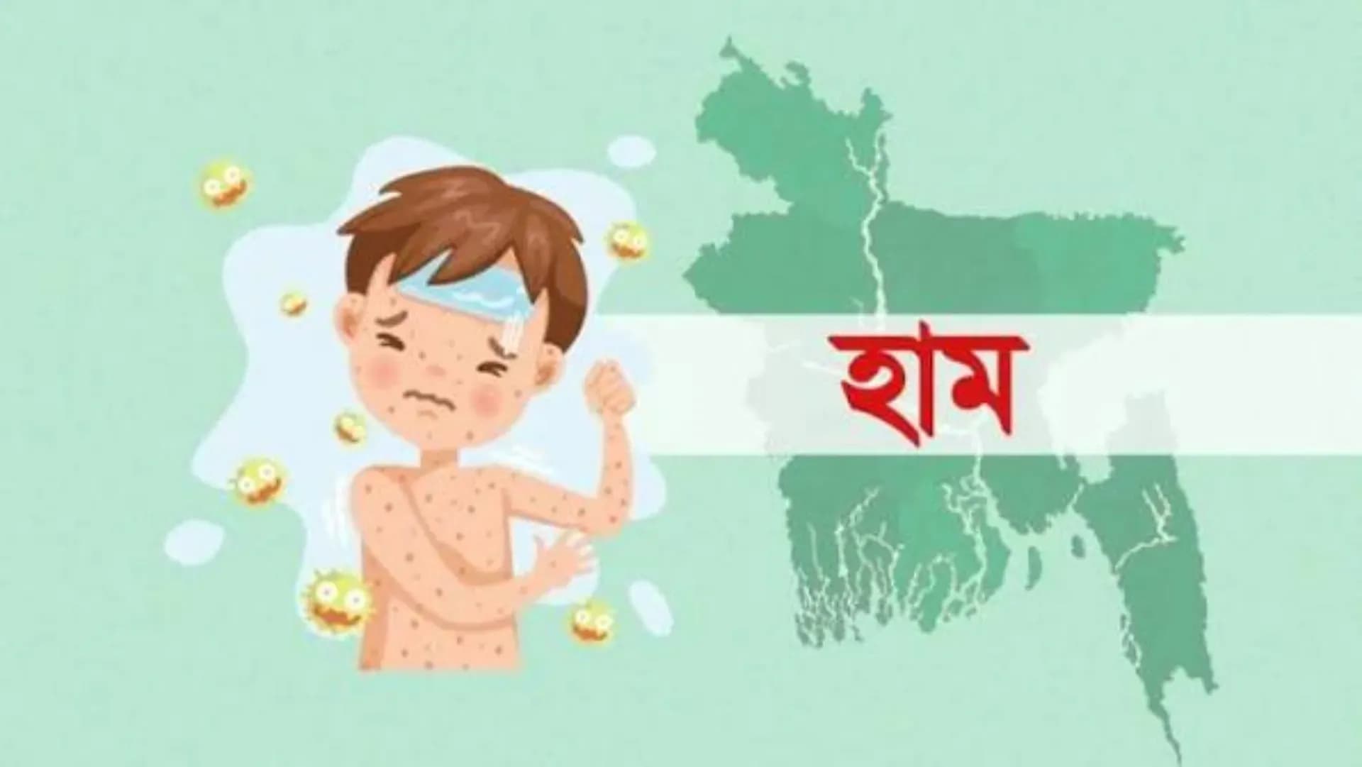 হাম উপসর্গে আরও ৮ জনের মৃত্যু
